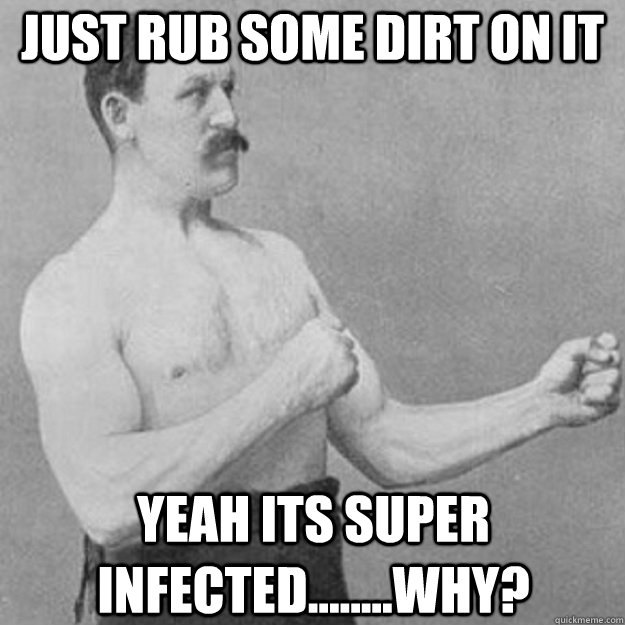 Just rub some dirt on it yeah its super infected........why?  overly manly man