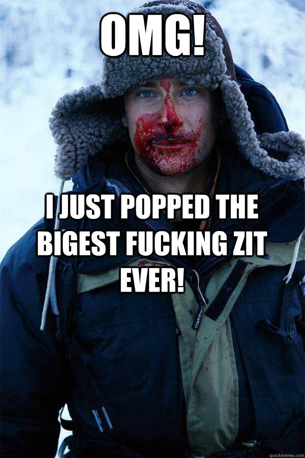 OMG! I just popped the bigest fucking zit ever!  Bear Grylls