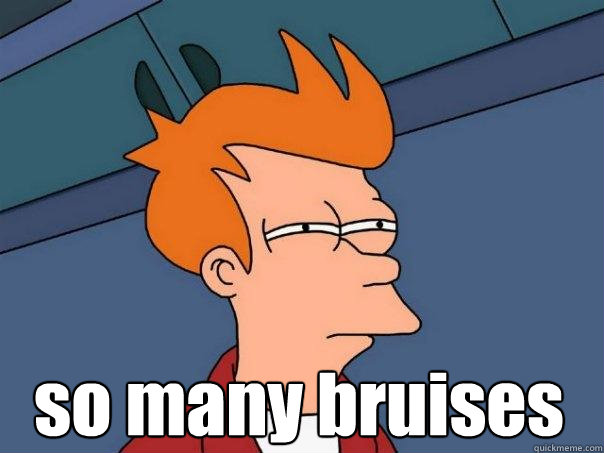  so many bruises -  so many bruises  Futurama Fry