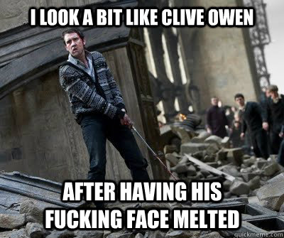 i look a bit like clive owen after having his fucking face melted  Neville owns