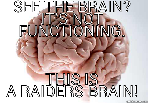 BRAIN DEAD - SEE THE BRAIN? IT'S NOT FUNCTIONING. THIS IS A RAIDERS BRAIN! Scumbag Brain