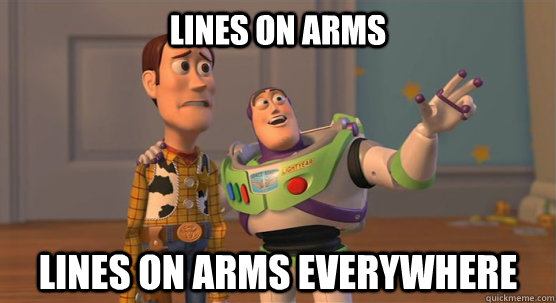 lines on arms lines on arms everywhere  Toy Story Everywhere