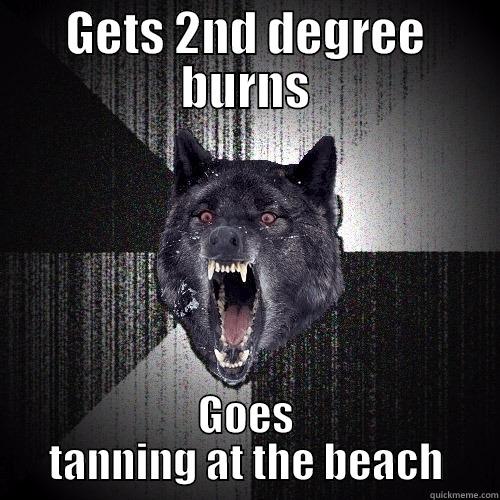 College girls - GETS 2ND DEGREE BURNS GOES TANNING AT THE BEACH Insanity Wolf