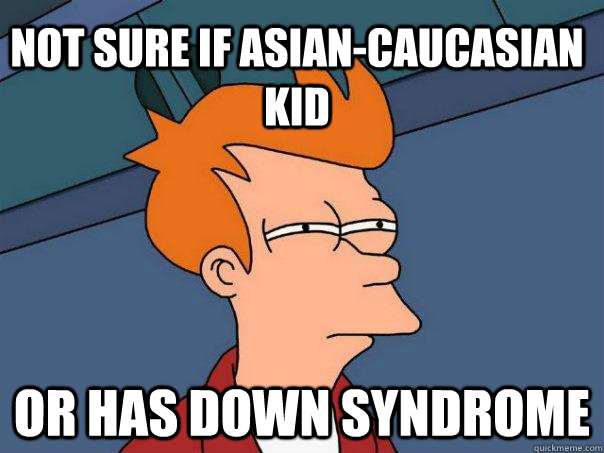 Not sure if asian-caucasian  kid Or has down syndrome  Futurama Fry