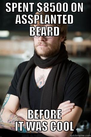 Assplanted beard - SPENT $8500 ON ASSPLANTED BEARD BEFORE IT WAS COOL Hipster Barista