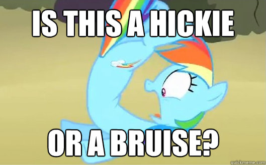 Is this a hickie or a bruise?  Rainbow Dash