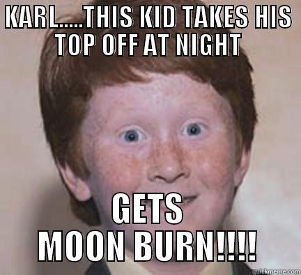 KARL.....THIS KID TAKES HIS TOP OFF AT NIGHT GETS MOON BURN!!!! Over Confident Ginger