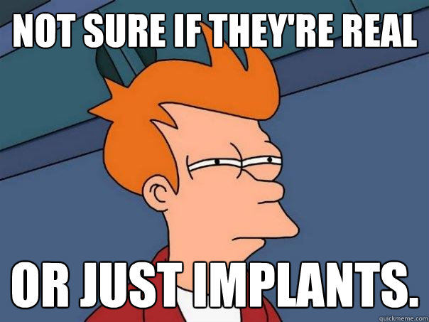 not sure if they're real or just implants.  Futurama Fry