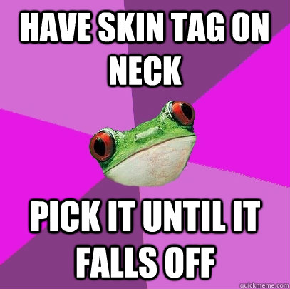 have skin tag on neck pick it until it falls off - have skin tag on neck pick it until it falls off  Foul Bachelorette Frog