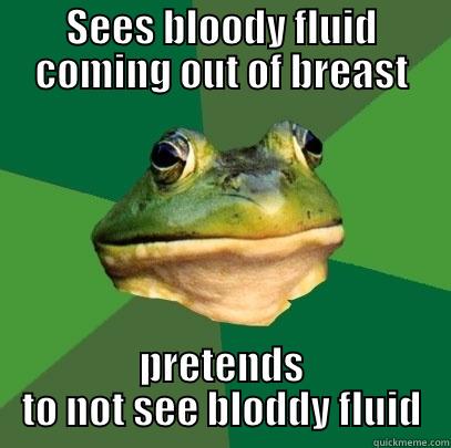 SEES BLOODY FLUID COMING OUT OF BREAST PRETENDS TO NOT SEE BLODDY FLUID Foul Bachelor Frog