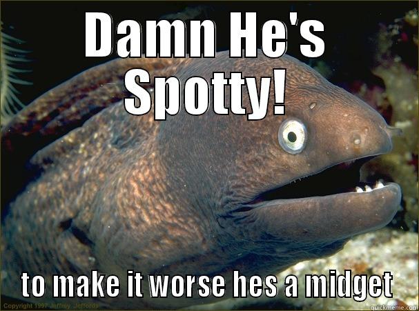 DAMN HE'S SPOTTY! TO MAKE IT WORSE HES A MIDGET Bad Joke Eel