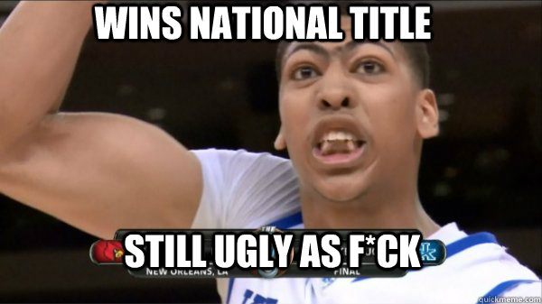 Wins national title Still ugly as f*ck - Wins national title Still ugly as f*ck  Anthony Davis Ugly