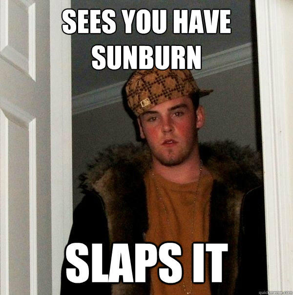 Sees you have sunburn slaps it  Scumbag Steve