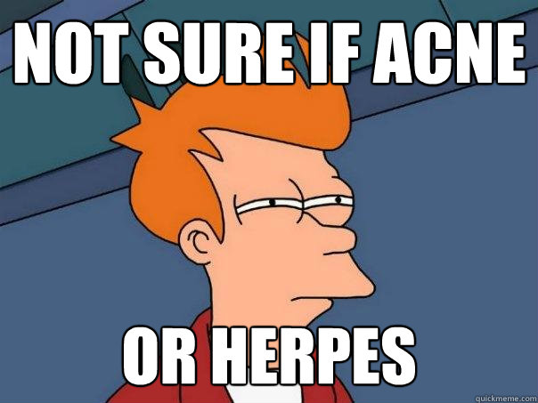 not sure if acne or herpes  Futurama Fry