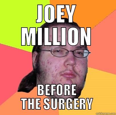 JOEY MILLION BEFORE THE SURGERY Butthurt Dweller