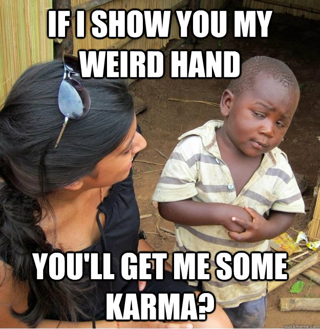 if i show you my weird hand you'll get me some karma?  Skeptical Third World Kid