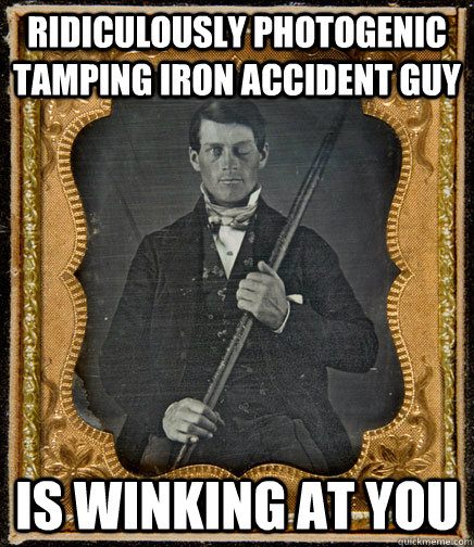 Ridiculously photogenic tamping iron accident guy is winking at you - Ridiculously photogenic tamping iron accident guy is winking at you  Misc