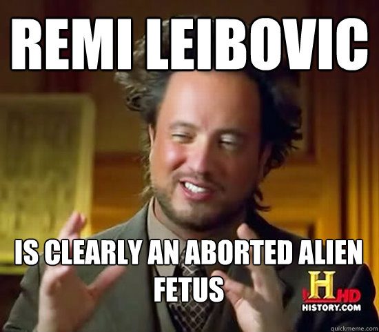 remi leibovic is clearly an aborted alien fetus  Ancient Aliens