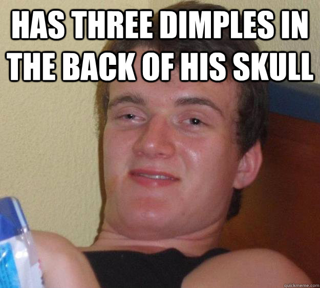 has three dimples in the back of his skull   10 Guy