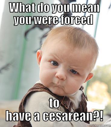 WHAT DO YOU MEAN YOU WERE FORCED  TO HAVE A CESAREAN?! skeptical baby