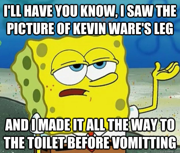 I'll have you know, I saw the picture of Kevin Ware's Leg And I made it all the way to the toilet before vomitting - I'll have you know, I saw the picture of Kevin Ware's Leg And I made it all the way to the toilet before vomitting  Tough Spongebob