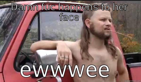 yee yee - DAMN FUC HAPPENS TO HER FACE EWWWEE  Almost Politically Correct Redneck