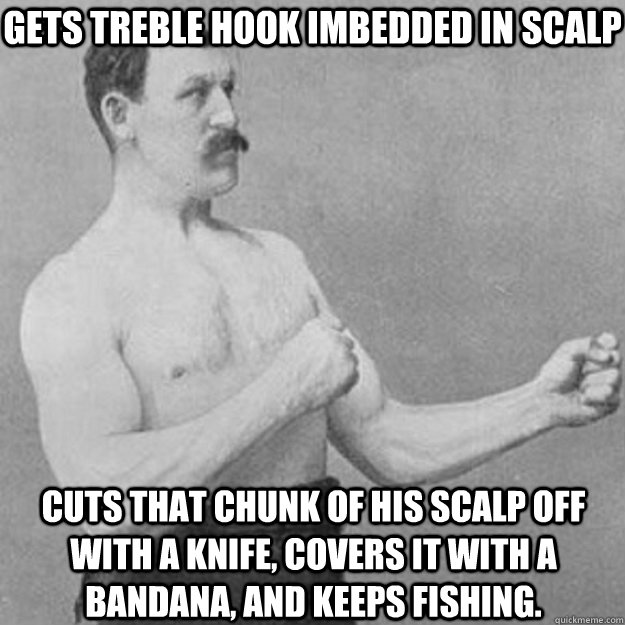 Gets treble hook imbedded in scalp Cuts that chunk of his scalp off with a knife, covers it with a bandana, and keeps fishing.  overly manly man