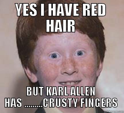 YES I HAVE RED HAIR BUT KARL ALLEN HAS .........CRUSTY FINGERS Over Confident Ginger