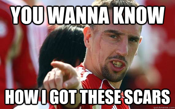 You wanna Know How I got these scars  Franck The Joker Ribery