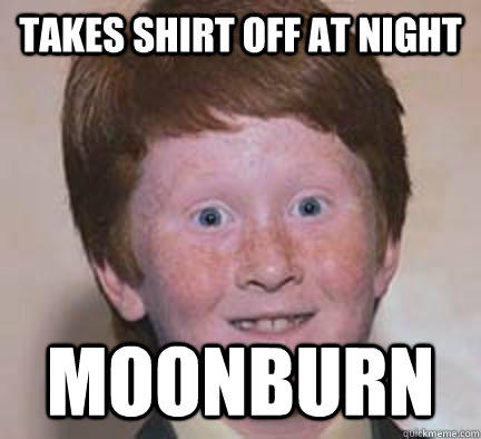 Takes shirt off at night moonburn  