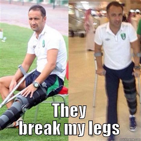 pereira funny -  THEY BREAK MY LEGS Misc