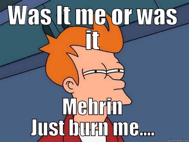 The Boy That Got Burned - WAS IT ME OR WAS IT MEHRIN JUST BURN ME.... Futurama Fry