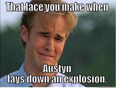 THAT FACE YOU MAKE WHEN AUSTYN LAYS DOWN AN EXPLOSION. 1990s Problems