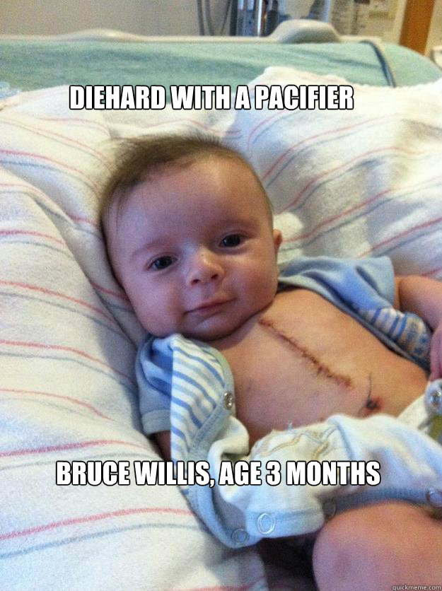 DIEHARD WITH A PACIFIER BRUCE WILLIS, AGE 3 MONTHS  Ridiculously Goodlooking Surgery Baby