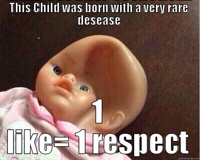 THIS CHILD WAS BORN WITH A VERY RARE DESEASE 1 LIKE= 1 RESPECT Misc