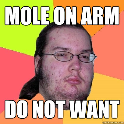 Mole on Arm DO NOT WANT  Butthurt Dweller