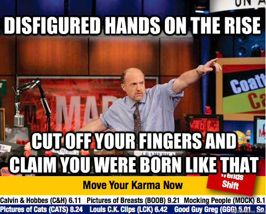 Disfigured hands on the rise Cut off your fingers and claim you were born like that  Mad Karma with Jim Cramer