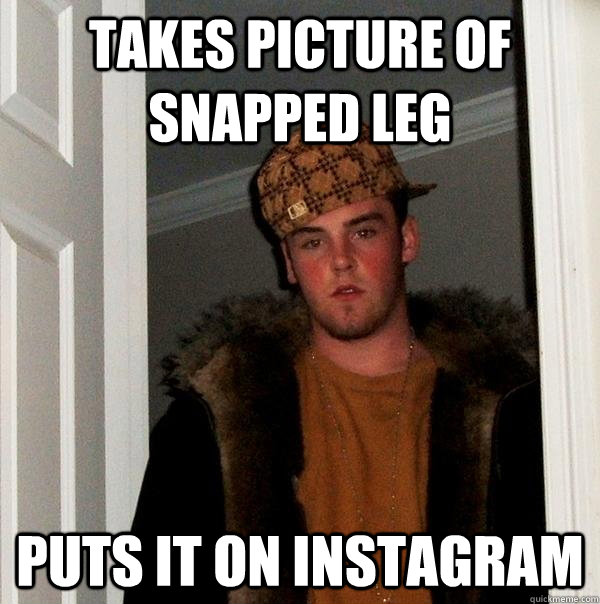 Takes picture of snapped leg puts it on instagram  Scumbag Steve