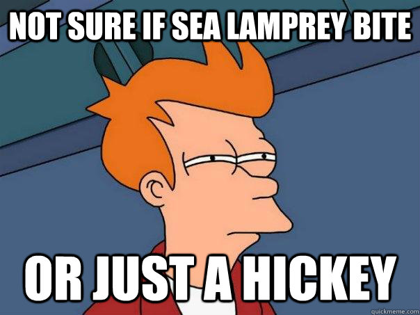 Not sure if sea lamprey bite Or just a hickey  Futurama Fry