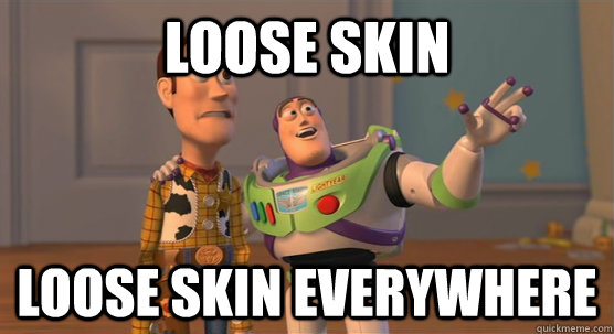 Loose Skin Loose skin everywhere  Toy Story Everywhere