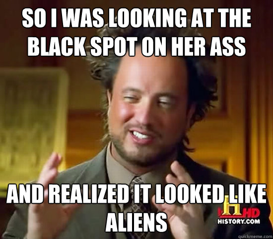 so I was looking at the black spot on her ass and realized it looked like aliens - so I was looking at the black spot on her ass and realized it looked like aliens  Ancient Aliens