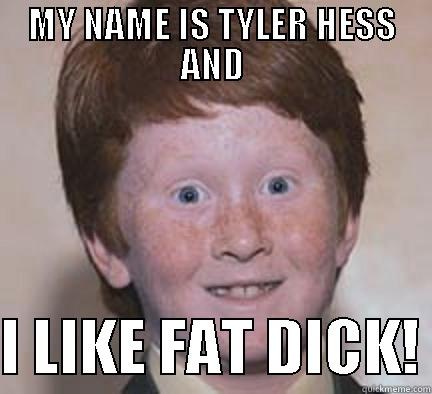 MY NAME IS TYLER HESS AND  I LIKE FAT DICK! Over Confident Ginger