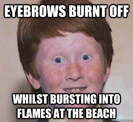 eyebrows burnt off whilst bursting into flames at the beach - eyebrows burnt off whilst bursting into flames at the beach  Over Confident Ginger