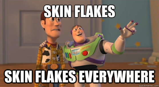 Skin flakes Skin flakes everywhere  Toy Story Everywhere