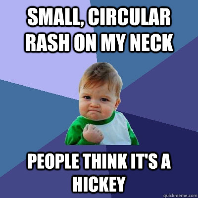 Small, circular Rash on my Neck People think it's a hickey  Success Kid