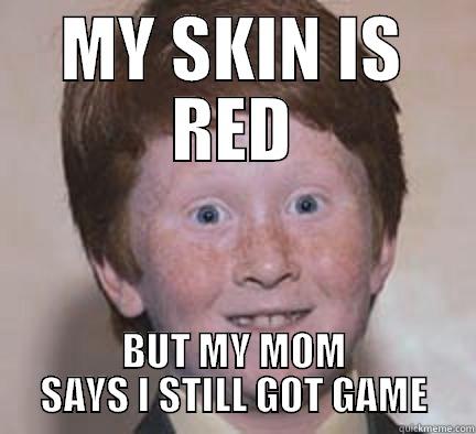 MY SKIN IS RED BUT MY MOM SAYS I STILL GOT GAME Over Confident Ginger