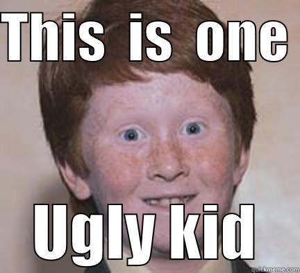 This  is one Ugly kid - THIS  IS  ONE  UGLY KID Over Confident Ginger