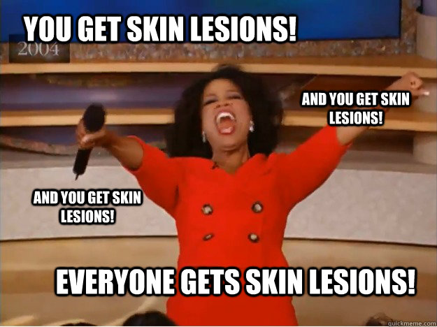 You get Skin Lesions! everyone gets Skin Lesions! and you get Skin Lesions! and you get Skin Lesions!  oprah you get a car