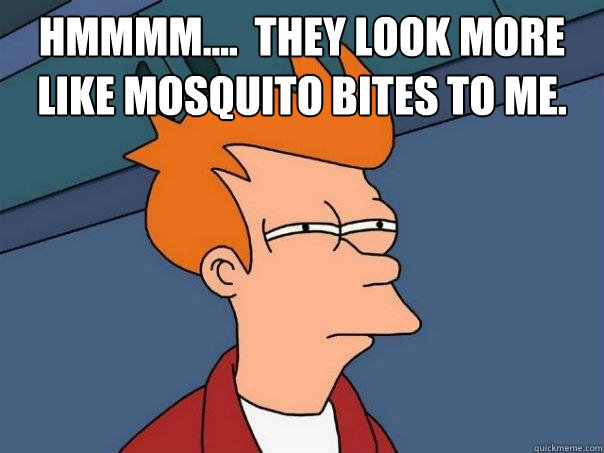 Hmmmm....  they look more like mosquito bites to me.  - Hmmmm....  they look more like mosquito bites to me.   Futurama Fry