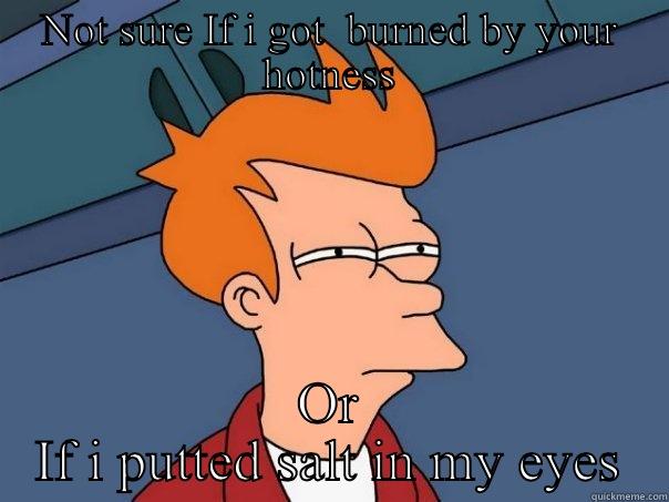 NOT SURE IF I GOT  BURNED BY YOUR HOTNESS OR IF I PUTTED SALT IN MY EYES Futurama Fry